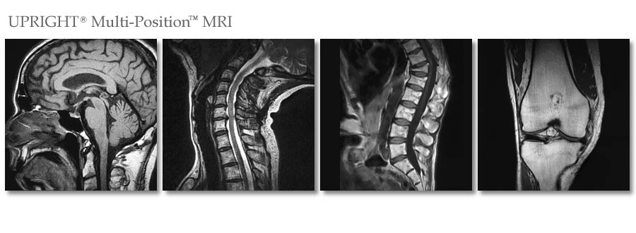 StandUp MRI of Carle Place